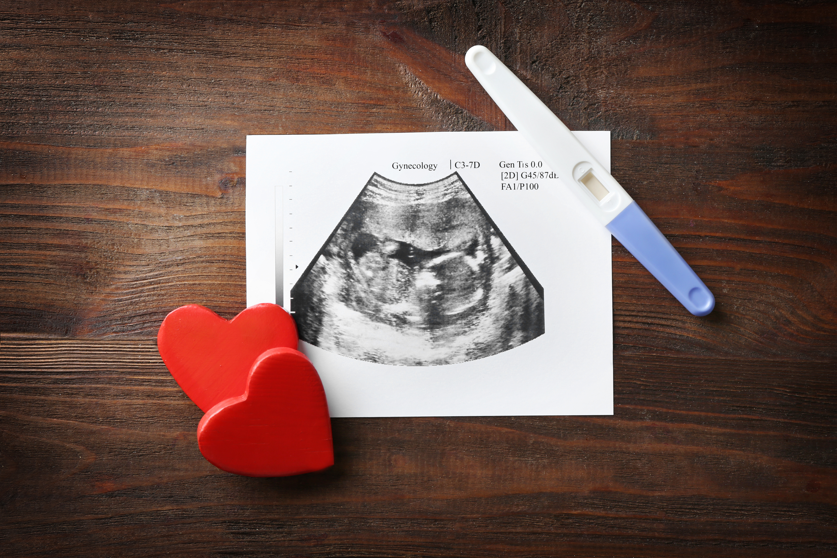 Снимок УЗИ беременности и тест на беременность